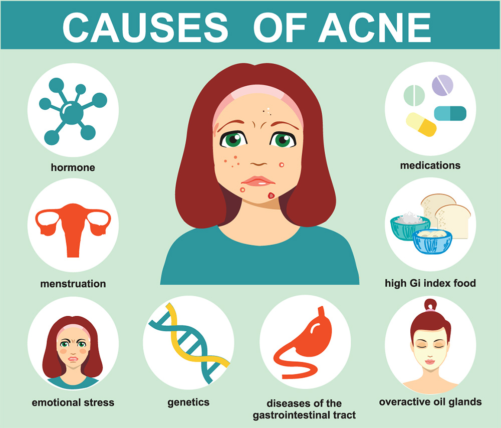 acne treatment Albury, oily skin, reduce acne inflammation