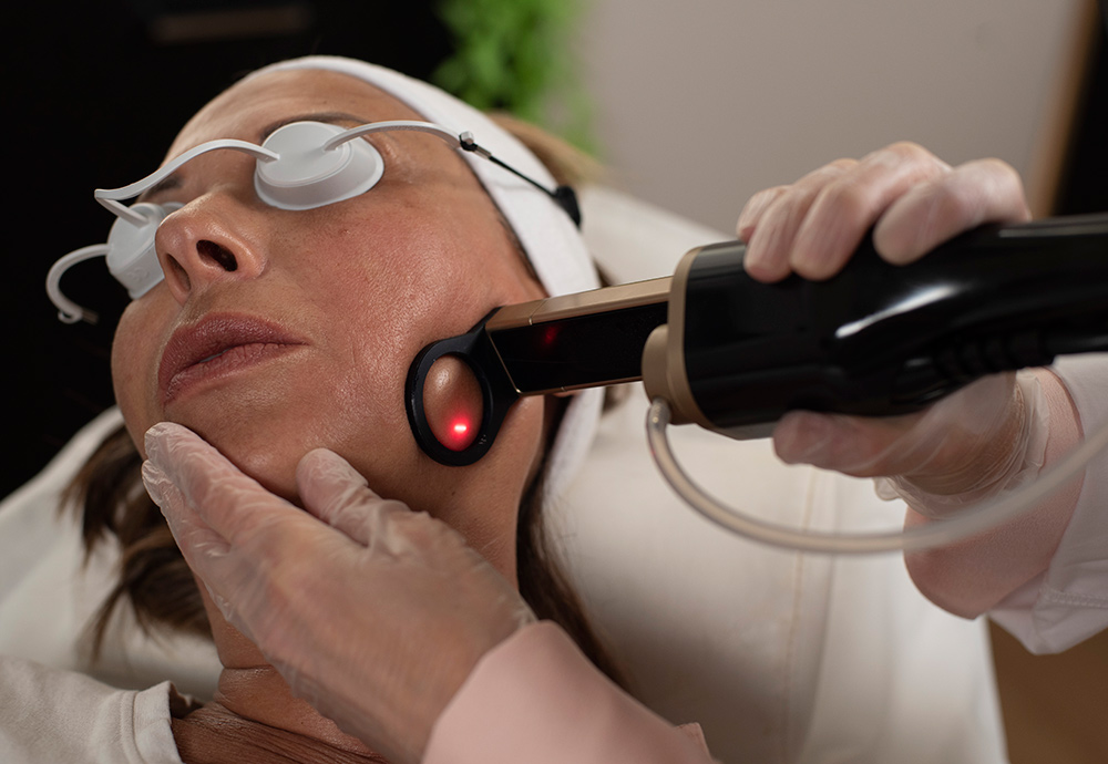 rosacea treatment, non-invasive treatment, skin sensitivity, gentle skincare