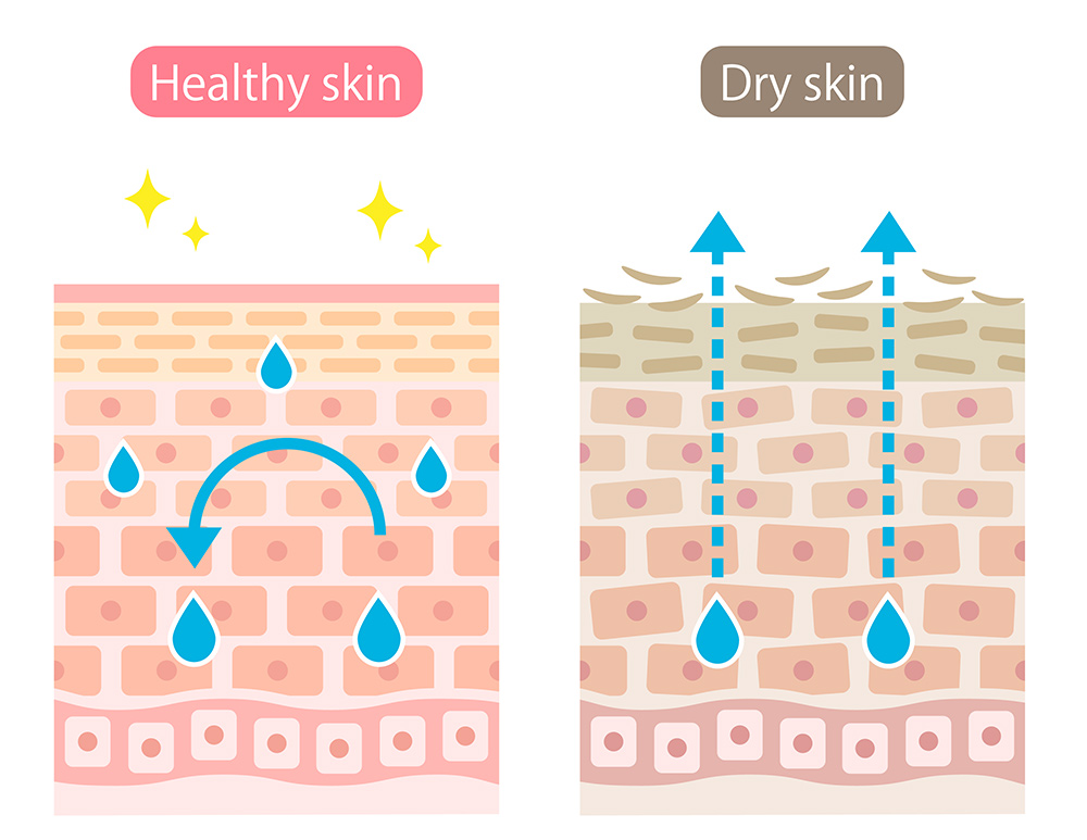 uneven skin texture, dry flaky skin, raised skin lesions