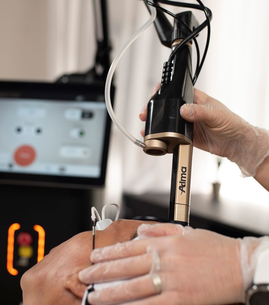 uneven skin tone, uneven skin tone treatment, blotchy skin, restore skin balance