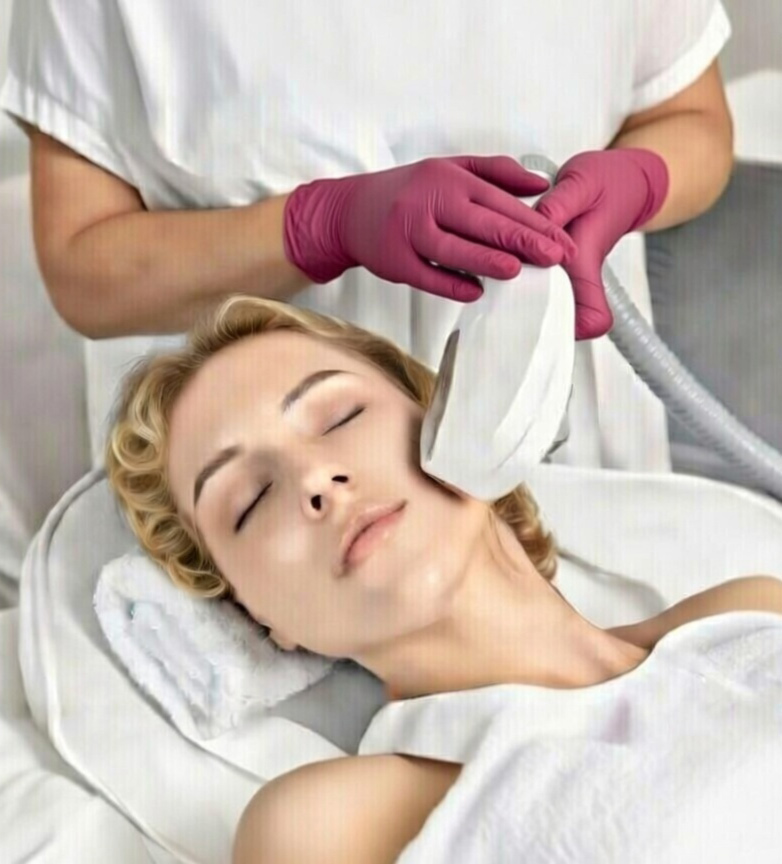 DYE VL Laser treatment, pigmentation laser Albury Wodonga, vascular laser therapy