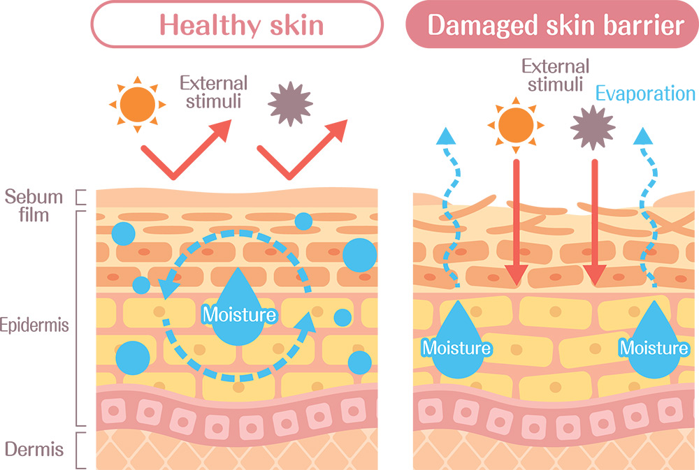 how to repair skin barrier, healthy skin barrier, skin barrier repair, hydrated skin