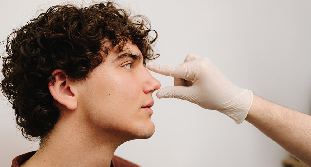 what is non surgical rhinoplasty, non surgical rhinoplasty, subtle nose refinement, cosmetic nose reshaping